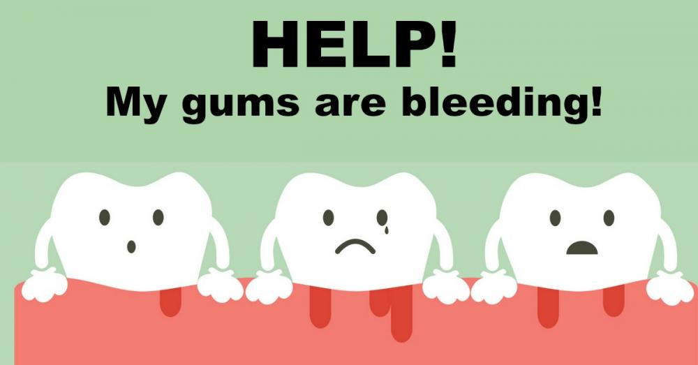 Phẫu thuật nha chu điều trị bệnh nha chu, viêm nướu lợi