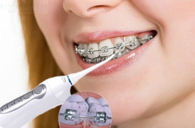 5 MẸO NHỎ GIÚP RĂNG LUÔN TRẮNG SÁNG, CHẮC KHỎE